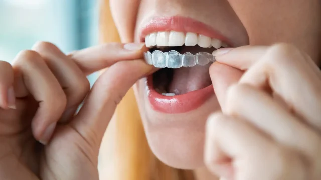 Dental Care